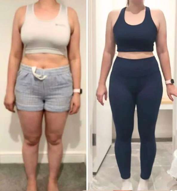 Becky before and after