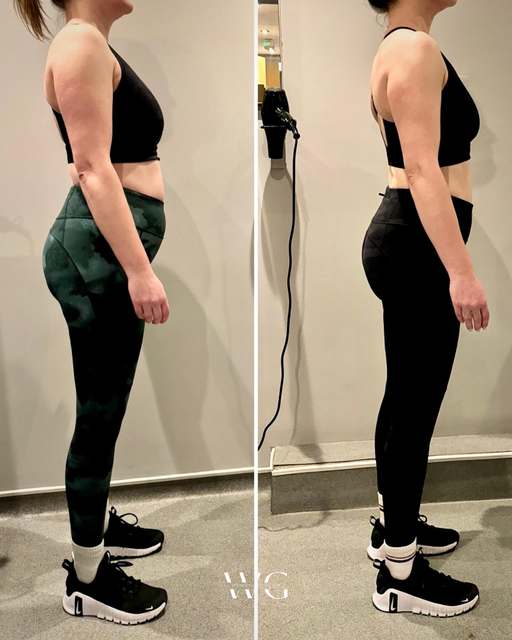 Suzy's before and after transformation